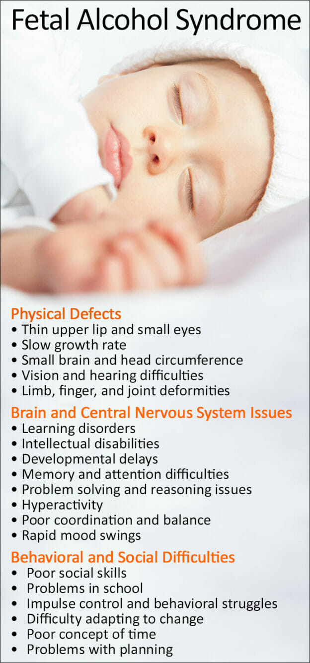 Fetal Alcohol Syndrome Symptoms Causes And Treatment 