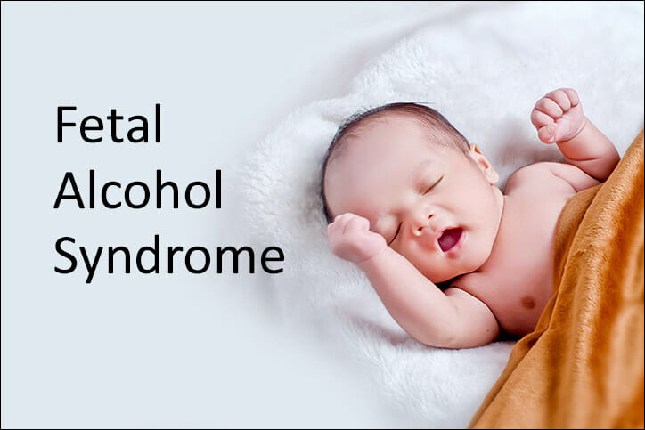 Fetal Alcohol Syndrome Symptoms, Causes and Treatment