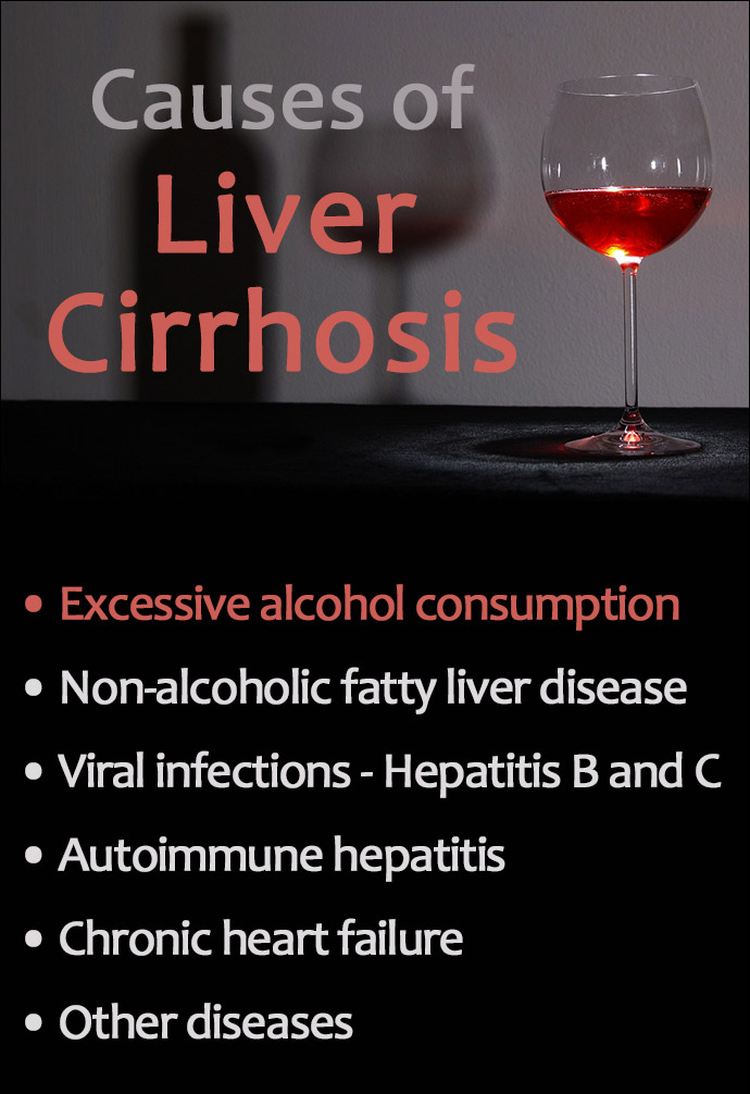 Liver Cirrhosis Causes