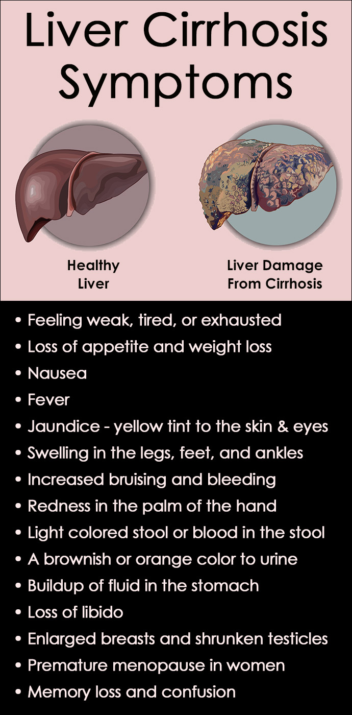 Liver Cirrhosis Symptoms