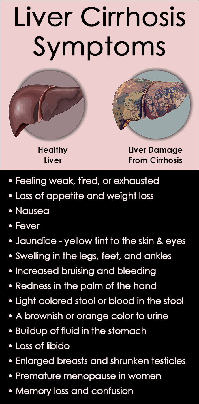 Liver Cirrhosis Symptoms Causes And Treatments SummitRehab