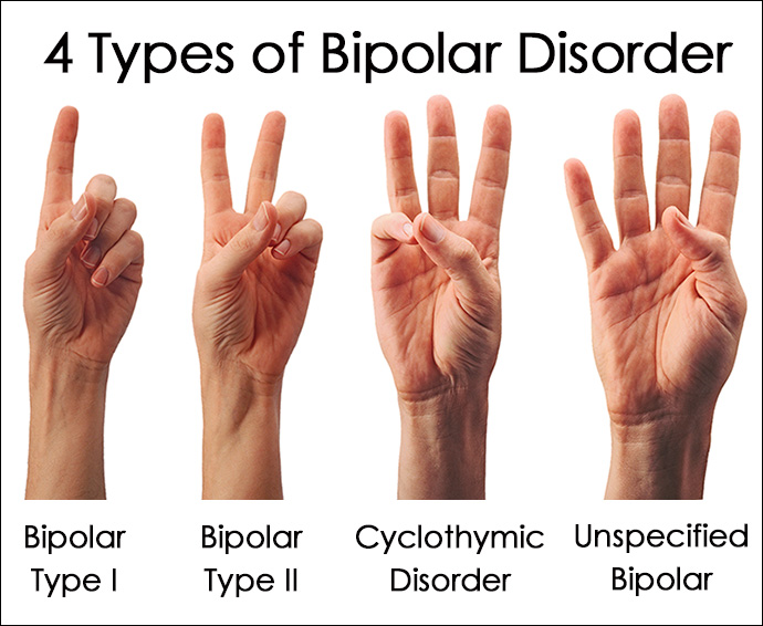 4 Types of Bipolar Disorder